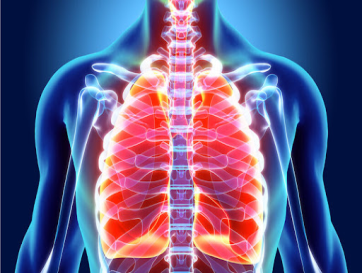 Foto com imagem ilustrando o tema de Asma e Bronquite