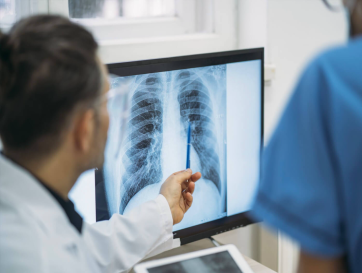 Foto com imagem ilustrando o tema de Fibrose Pulmonar